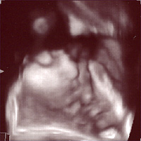 4D�����g�G�R�[1