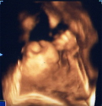 4D�����g�G�R�[2